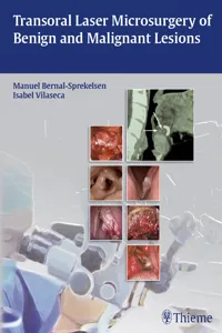Transoral Laser Microsurgery of Benign and Malignant Lesions_cover