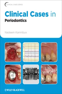 Clinical Cases in Periodontics_cover