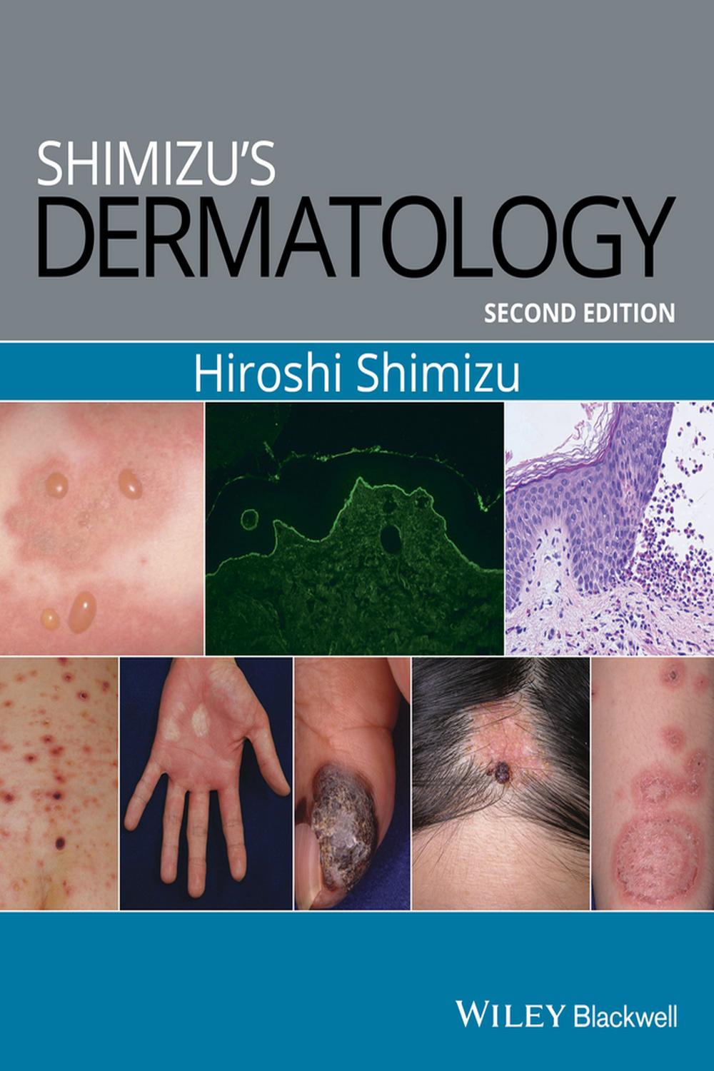 PDF] Shimizu's Dermatology by Hiroshi Shimizu eBook | Perlego