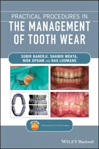 Practical Procedures in the Management of Tooth Wear_cover