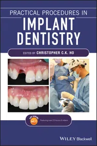 Practical Procedures in Implant Dentistry_cover