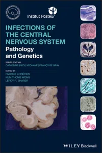 Infections of the Central Nervous System_cover