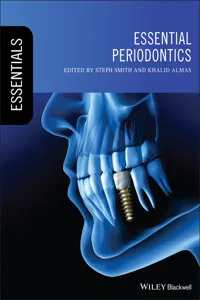Essential Periodontics_cover