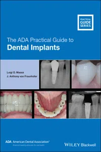The ADA Practical Guide to Dental Implants_cover