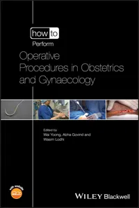 How to Perform Operative Procedures in Obstetrics and Gynaecology_cover