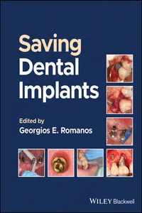 Saving Dental Implants_cover