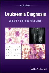 Leukaemia Diagnosis_cover