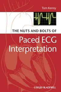 The Nuts and bolts of Paced ECG Interpretation_cover