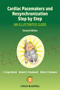 Cardiac Pacemakers and Resynchronization Step by Step_cover